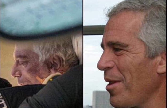 Epstein auf dem Weg ins Krankenhaus